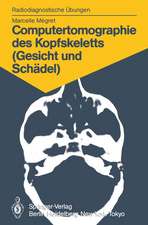 Computertomographie des Kopfskeletts (Gesicht und Schädel): 58 diagnostische Übungen für Studenten und praktische Radiologen