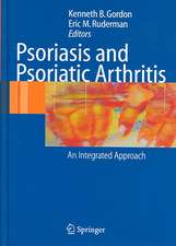 Psoriasis and Psoriatic Arthritis: An Integrated Approach