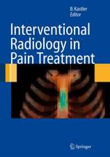 Interventional Radiology in Pain Treatment