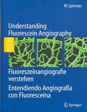 Understanding Fluorescein Angiography, Fluoreszeinangiografie verstehen, Entendiendo Angiografía con Fluoresceína