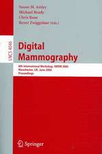 Digital Mammography: 8th International Workshop, IWDM 2006, Manchester, UK, June 18-21, 2006, Proceedings