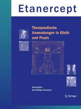 Etanercept - Therapeutische Anwendungen in Klinik und Praxis