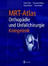 Mrt-Atlas Orthopadie Und Unfallchirurgie