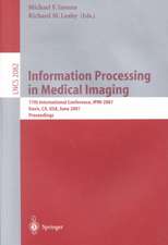 Information Processing in Medical Imaging: 17th International Conference, IPMI 2001, Davis, CA, USA, June 18-22, 2001. Proceedings