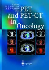 PET and PET-CT in Oncology