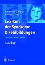 Lexikon Der Syndrome Und Fehlbildungen