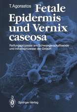 Fetale Epidermis und Vernix caseosa