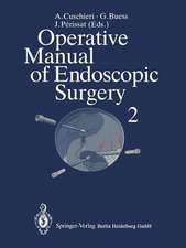 Operative Manual of Endoscopic Surgery 2