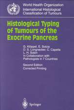 Histological Typing of Tumours of the Exocrine Pancreas