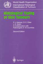 Histological Typing of Skin Tumours