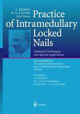 Practice of Intramedullary Locked Nails: Advanced Techniques and Special Applications Recommended by “Association Internationale pour l’Ostéosynthèse Dynamique” (AIOD)