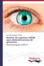 Analisis de Registros Mferg Para Deteccion Precoz de Glaucoma