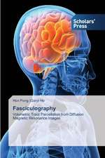 Fasciculography