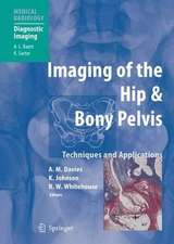 Imaging of the Hip & Bony Pelvis: Techniques and Applications