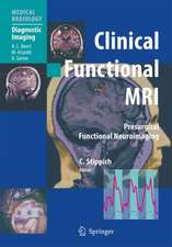 Clinical Functional MRI: Presurgical Functional Neuroimaging