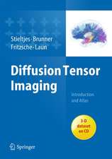 Diffusion Tensor Imaging: Introduction and Atlas