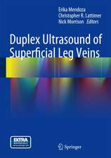 Duplex Ultrasound of Superficial Leg Veins