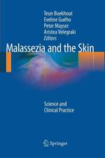 Malassezia and the Skin: Science and Clinical Practice