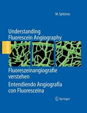 Understanding Fluorescein Angiography, Fluoreszeinangiografie verstehen, Entendiendo Angiografía con Fluoresceína