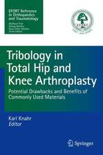 Tribology in Total Hip and Knee Arthroplasty: Potential Drawbacks and Benefits of Commonly Used Materials