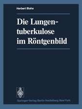 Die Lungentuberkulose im Röntgenbild