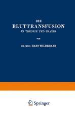 Die Bluttransfusion in Theorie und Praxis