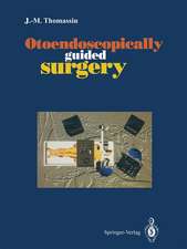 Otoendoscopically guided surgery