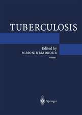 Tuberculosis