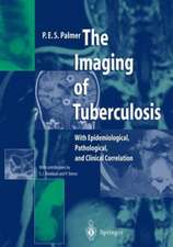 The Imaging of Tuberculosis: With Epidemiological, Pathological, and Clinical Correlation