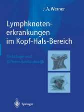 Lymphknotenerkrankungen im Kopf-Hals-Bereich: Onkologie und Differenzialdiagnostik