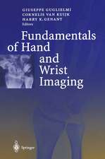 Fundamentals of Hand and Wrist Imaging