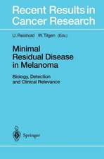 Minimal Residual Disease in Melanoma: Biology, Detection and Clinical Relevance