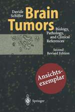 Brain Tumors: Biology, Pathology and Clinical References