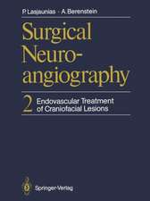 Surgical Neuroangiography: 2 Endovascular Treatment of Craniofacial Lesions