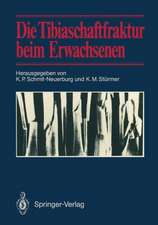 Die Tibiaschaftfraktur beim Erwachsenen: Symposium anläßlich des 10jährigen Bestehens der Abteilung für Unfallchirurgie am Klinikum Essen, 1./2. Februar 1985 in Essen