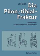 Die Pilon-tibial-Fraktur: Klassifikation, Operationstechnik, Ergebnisse