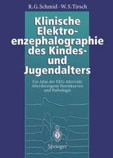 Klinische Elektroenzephalographie des Kindes- und Jugendalters: Ein Atlas der EEG-Aktivität: Altersbezogene Normkurven und Pathologie