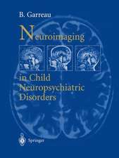 Neuroimaging in child neuropsychiatric disorders