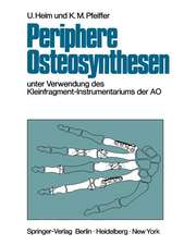 Periphere Osteosynthesen: Unter Verwendung des Kleinfragment-Instrumentariums der AO