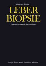 Leberbiopsie: Ein klinischer Atlas der Histopathologie