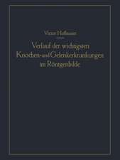 Verlauf der wichtigsten Knochen- und Gelenkerkrankungen im Röntgenbilde: Eine anschauliche Prognostik