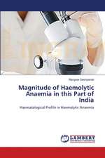 Magnitude of Haemolytic Anaemia in this Part of India