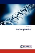 Peri-Implantitis