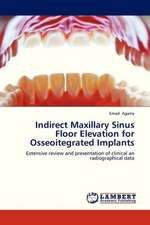 Indirect Maxillary Sinus Floor Elevation for Osseoitegrated Implants