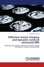 Diffusion tensor imaging and dynamic contrast enhanced MRI