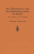 Die Tuberkulose und ihre Bekämpfung durch die Schule: Eine Anweisung für die Lehrerschaft