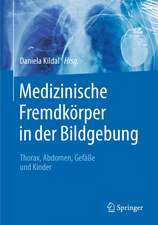 Medizinische Fremdkörper in der Bildgebung: Thorax, Abdomen, Gefäße und Kinder