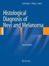 Histological Diagnosis of Nevi and Melanoma