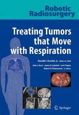 Robotic Radiosurgery. Treating Tumors that Move with Respiration