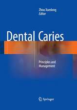 Dental Caries: Principles and Management